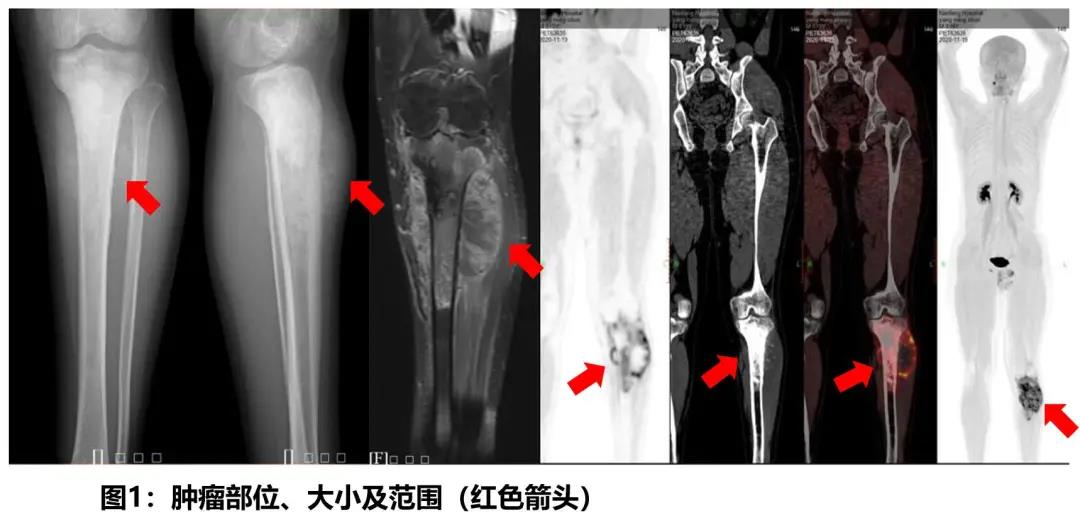 圖片關鍵詞